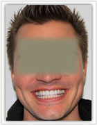 1 after