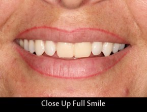 close-up-full-smile
