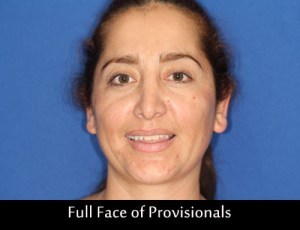 full-face-of-provisionals_pp